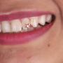 Adastra Jewelry 18k Rose Gold Over 925 Sterling Silver Teeth Charm Star