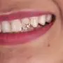 Adastra Jewelry 18k Rose Gold Over 925 Sterling Silver Teeth Charm Star Adastra Jewelry 18k Rose Gold Over 925 Sterling Silver Teeth Charm Star