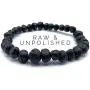 Adult Raw Baltic Amber Bracelet - All Natural Pain Relief for Adults to Help Migraines, Sinus, Arthritis and More! Raw Dark Cherry (Large)